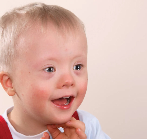 Олигофрения в Усолье-Сибирском